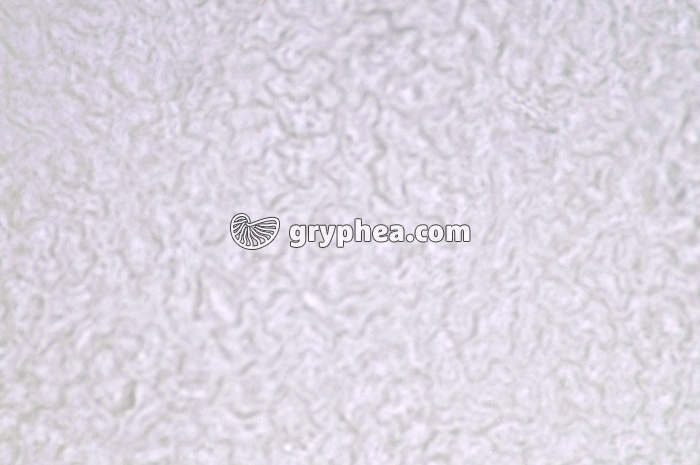 Stomates d'une feuille de Lierre - vue de la face supérieure (adfaxiale) x60 - gryphea.com